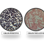 GRAM STAINING: GRAM-POSITIVE VS GRAM-NEGATIVE BACTERIA