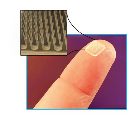 Microneedles Intelligent Technology for Transdermal Drug Delivery